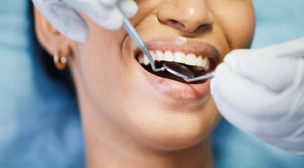 Best Emergency Dental Care for Broken or Chipped Teeth in St Helen, MI