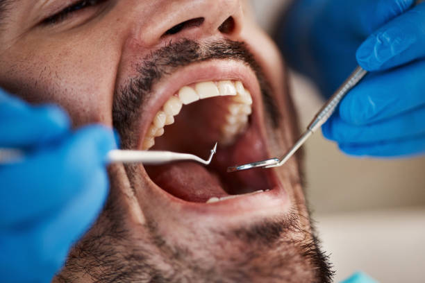 Best Cosmetic Emergency Dentistry in St Helen, MI