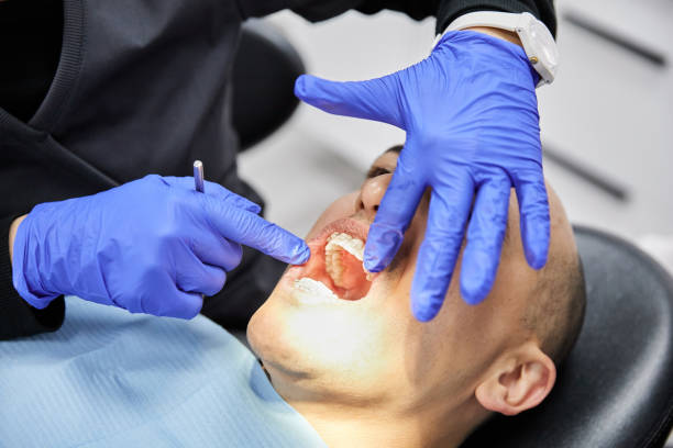 Best Emergency Gum Treatment in St Helen, MI